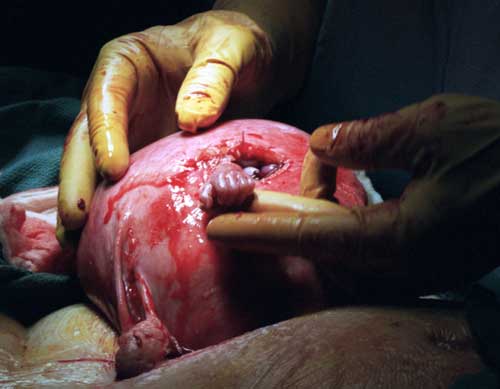 At 21 weeks, the child reaches out. 